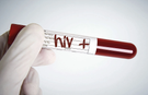 HIV/AIDS iddiaları gündemdeki yerini koruyor!