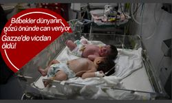 İsrail, Gazze'de soykırım yapmaya devam ediyor: Gazze'de bebekler açlıktan ölüyor