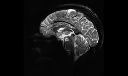İnsan beyninin en net görüntüsü yayınlandı
