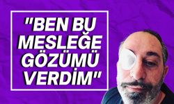 Cem Yılmaz: Sağ gözüm yüzde 50 görmüyor