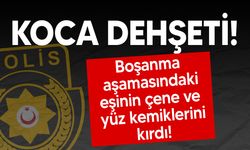 Restoranda boşanma aşamasındaki eşini ciddi şekilde darp etti!