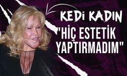 Kedi Kadın Jocelyn Wildenstein'den estetik açıklaması: "Hiç estetik yaptırmadım"