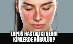 Lupus hakkında uzmanlar uyardı