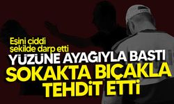 Gönyeli’de Eşine Şiddet Uygulayan Şahıs Tutuklandı