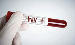 HIV/AIDS iddiaları gündemdeki yerini koruyor!