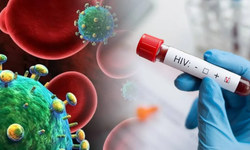 HIV/AİDS tartışması büyüyor!