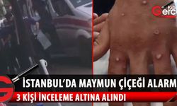 İstanbul'da maymun çiçeği alarmı! Ellerinde yaralar çıkan 3 kişi ekipler tarafından alındı, test sonuçları bekleniyor
