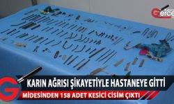 25 yaşındaki kadının midesinden tırnak makası dahil 158 adet cisim çıkarıldı