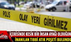 Beylerbeyi'nde kesik ayak!