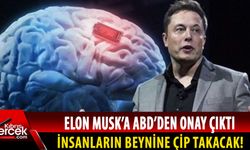Elon Musk, insan beynine çip takacak