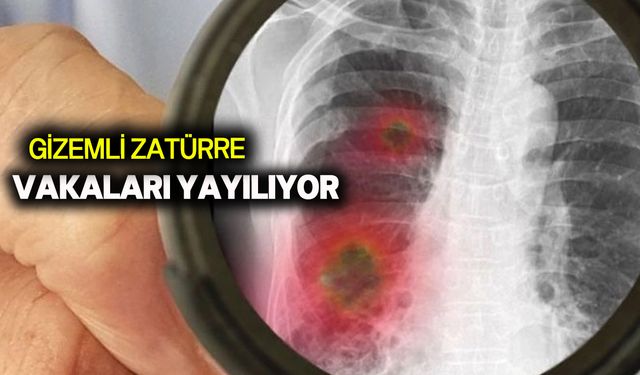 zatürre vakalarının çocuklar arasında yayıldığı belirtildi