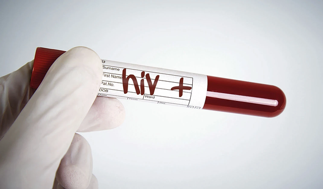 HIV/AIDS iddiaları gündemdeki yerini koruyor!