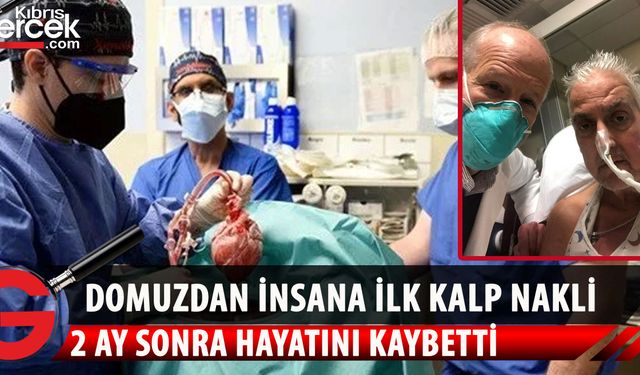 Domuzdan insana ilk kalp naklinin yapıldığı kişi, 2 ay sonra yaşamını yitirdi