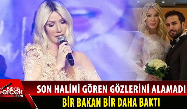 Estetiklerine bir yenisini daha ekleyen Seda çenesine kontür yaptırdı
